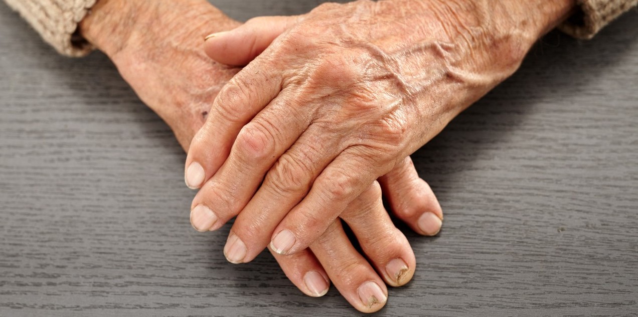 Stadi evolutii artrite reumatoide
