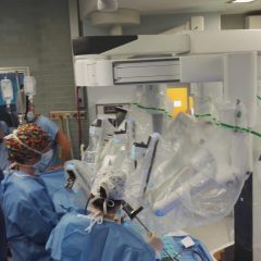 Prelievo di rene in chirurgia robotica avanzata a Padova